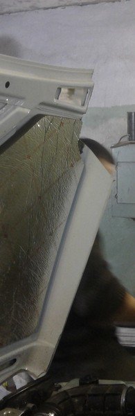 Установка шноркеля в НИВУ